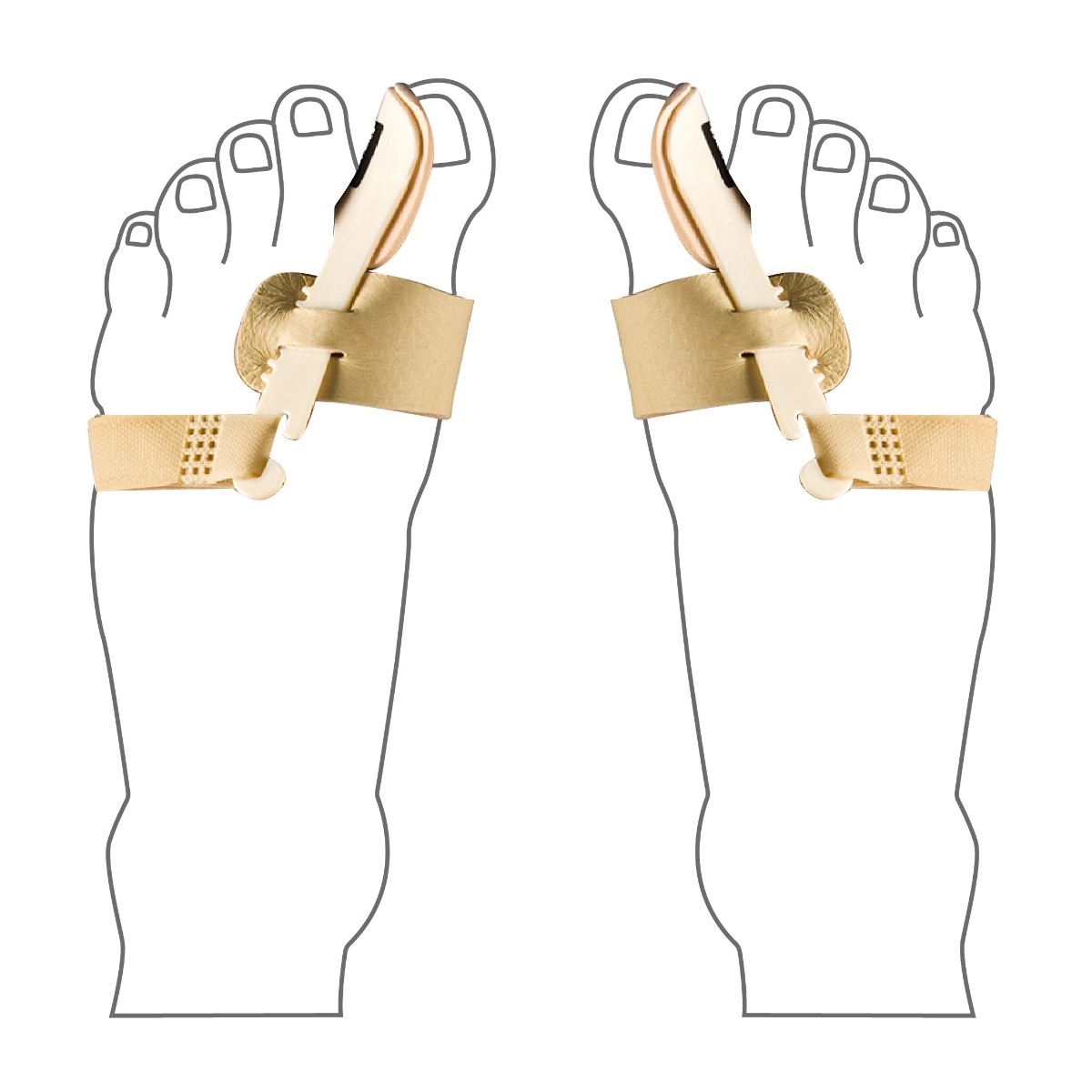 Вальгусная ночная шина Halux Valgus Bandage (правая), Uriel 388
Вальгусная ночная шина Halux Valgus Bandage (правая), Uriel 388