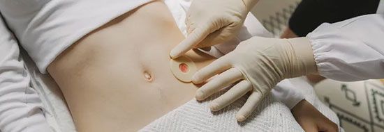 Диета при илеостоме: продукты, снижающие объем, запах, газообразования