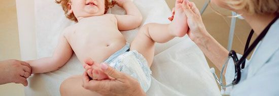Дисплазія кульшових суглобів у дітей: як визначити та лікувати, основні симптоми