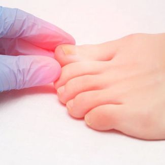Грибковые поражения ногтей: чем лечить и как предотвратить?