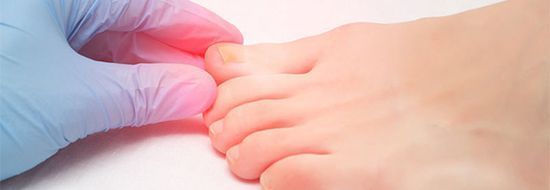 Грибковые поражения ногтей: чем лечить и как предотвратить?