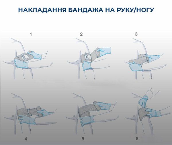 Как намотать эластичный бинт на руку