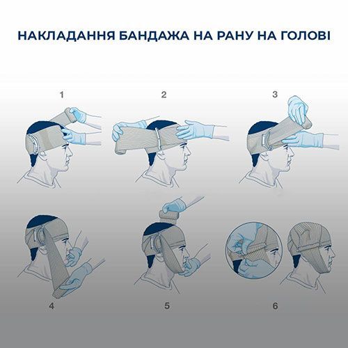 Накладання бандажа на рану на голові